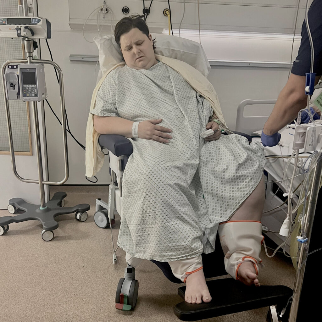 Em North hours after gastric bypass surgery in July 2025
